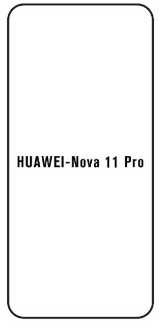 Hydrogel - protective film - Huawei Nova 11 Pro